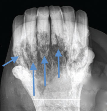 EOTRH x-ray