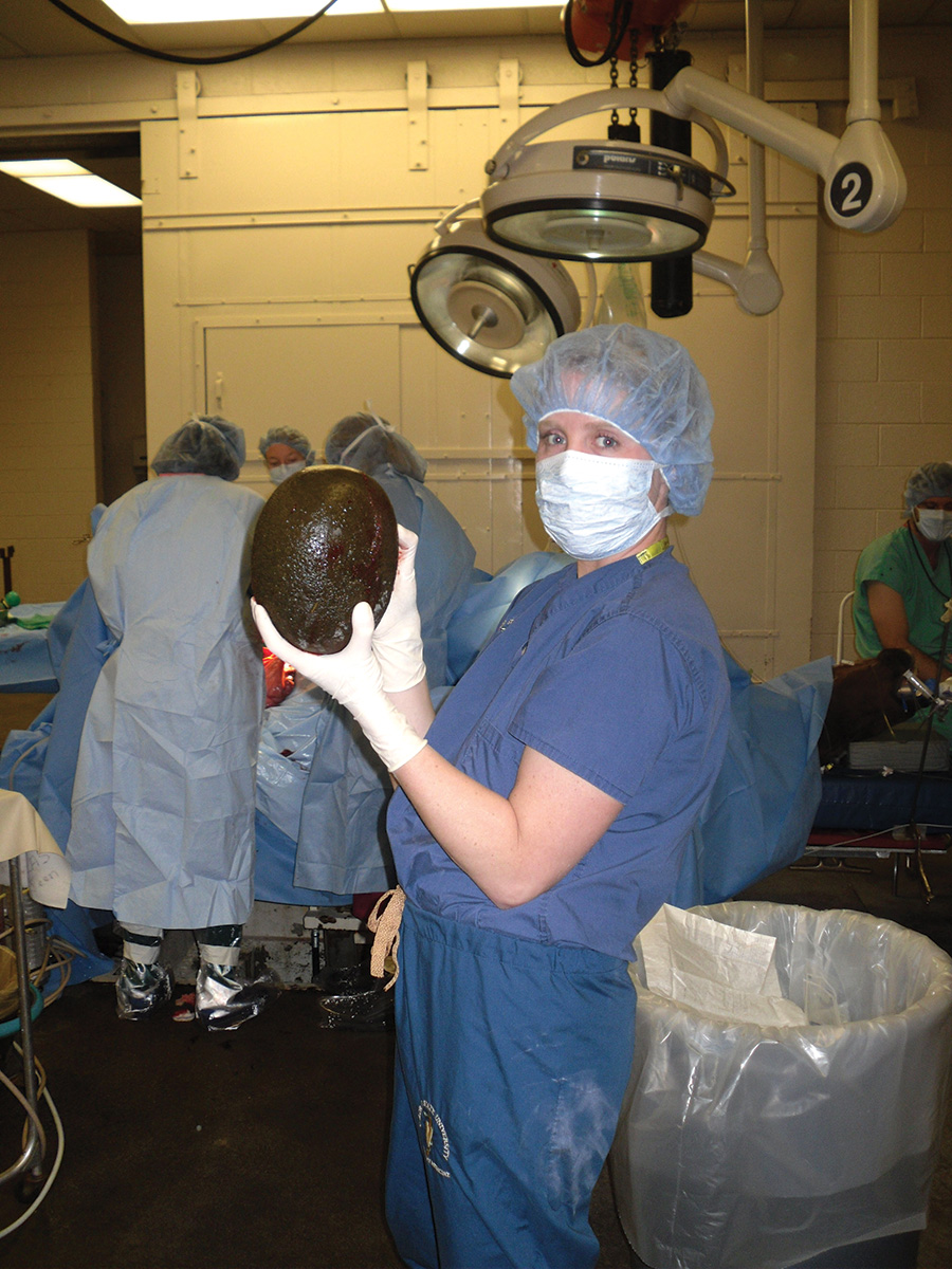 A large enterolith removed during surgery after a blockage was discovered.