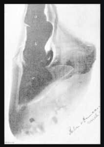 The first radiograph of a horse's hoof