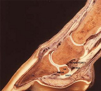 navicular