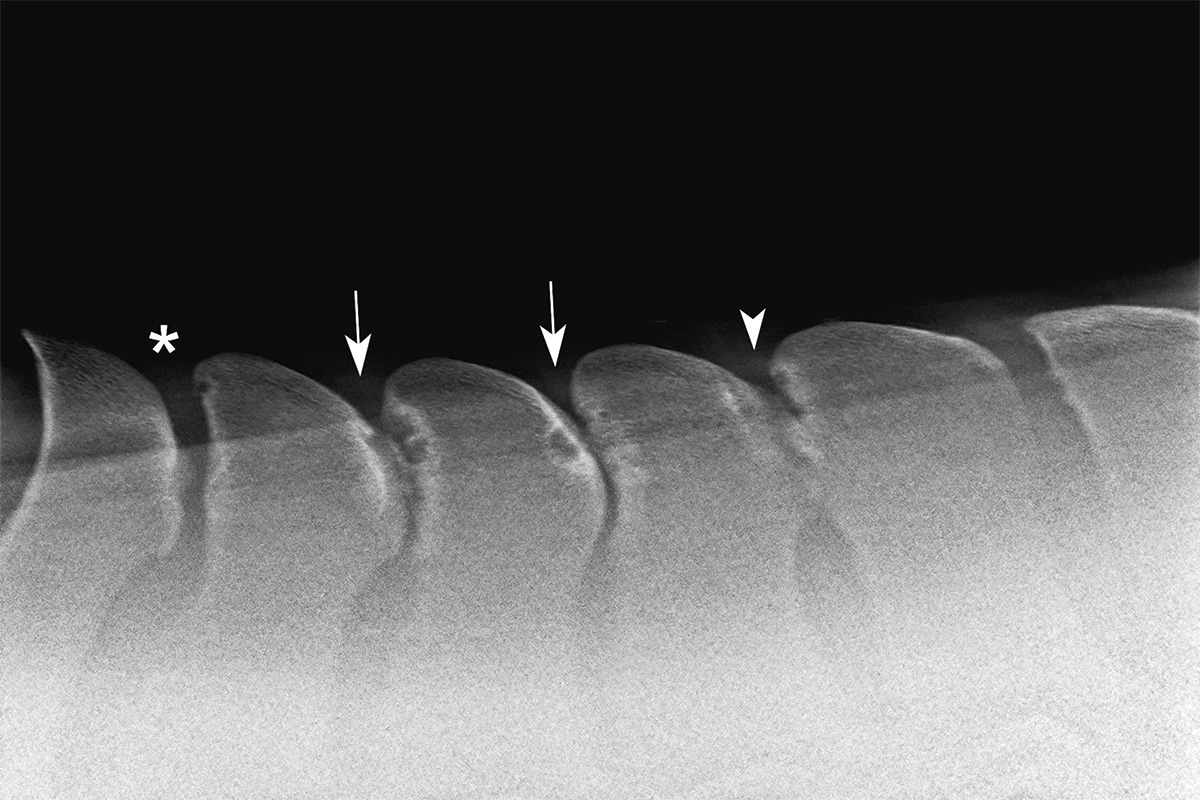 A DSP of a horse with kissing spine showing four sites of impingement